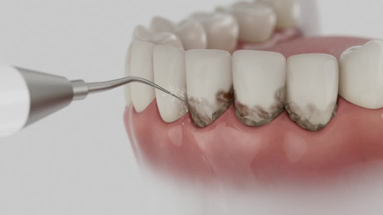 Reliable Root Canal Treatment contractor in Miller County County, AR by Dentist Open Now
